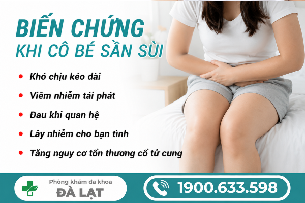 Hình ảnh minh họa